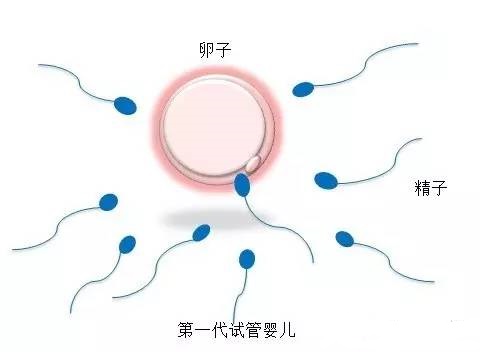 无精症案例